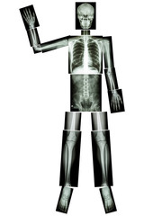Good Bye EBOLA. (Human bone wave the hand) (Whole body : head neck spine shoulder arm elbow forearm...