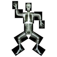 Aerobic Dance(human bone is dancing),(Whole body x-ray : head ,neck ,thorax ,shoulder ,arm ,elbow...