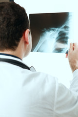 Potrait of doctor looking at chest x ray