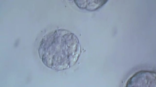 Fertility Doctor With A Microscope, A Syringe And Petri Dish Fertilization Of Eggs And Research In Reproduction Clinics. 