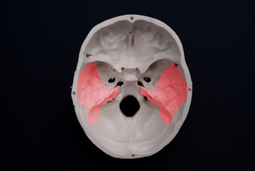 Temporal Bone 