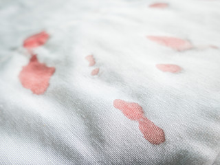 Composite of blood stains on white cotton fabric.