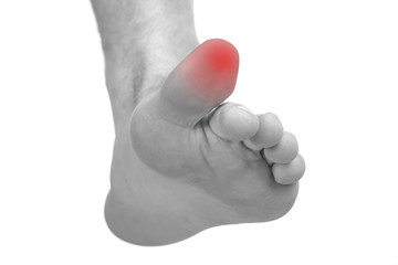 Painful Toe