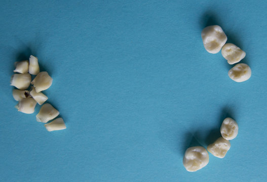 Alle Milchz&auml;hne in Rente.