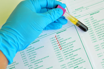 Blood sample for hematology testing