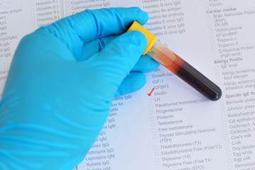 Blood sample for insulin hormone testing