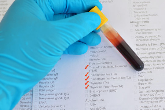 Blood sample for thyroid hormone testing