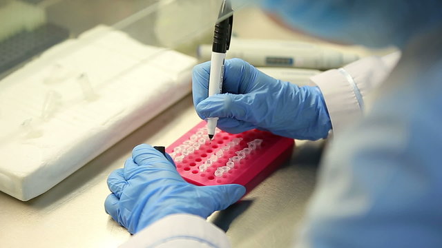 Microbiological laboratory work with tests