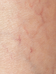 Fototapeta premium veins on the skin. close