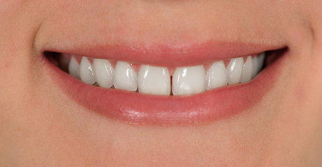 Naklejka premium Smile with teeth