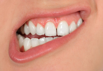 Smile with teeth