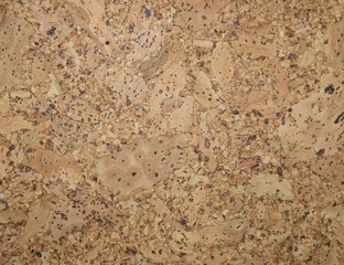 The structure of cork coverings