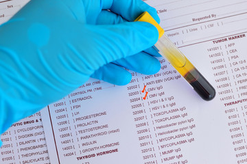 Cytomegalovirus testing