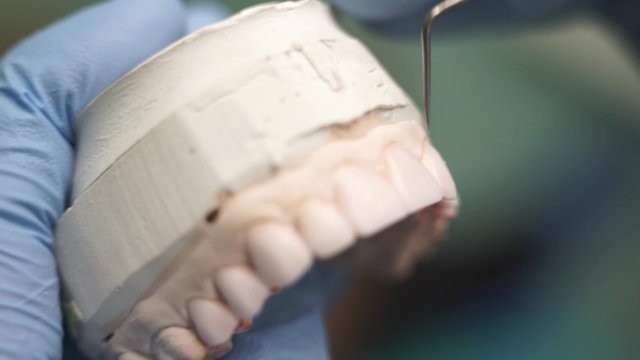 prosthetics cast in the hands of the dentist