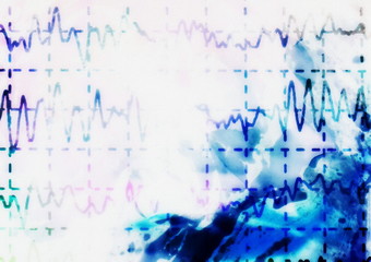 brain wave on electroencephalogram EEG for epilepsy, illustration