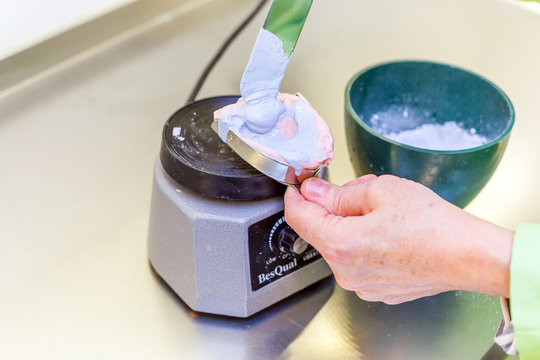 Dental Impression In Dental Laboratory