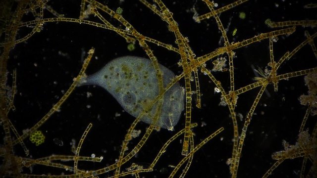 Mikroorganismus unter dem Dunkelfeldmikroskop - Mikrokosmos - 1080p Full HD