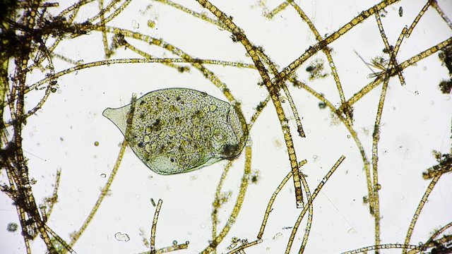 Mikroorganismus unter dem Mikroskop - Mikrokosmos - 1080p Full HD