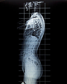Radiografia 