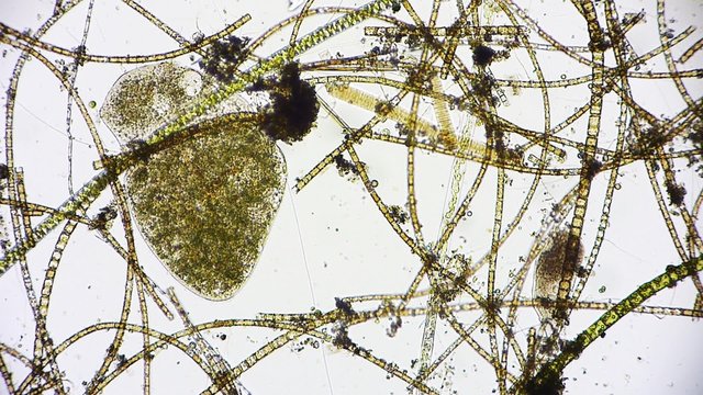 Mikroorganismus unter dem Mikroskop - Mikrokosmos - 1080p Full HD