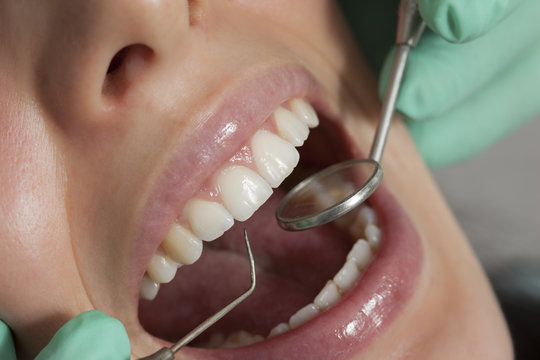 Close-up Of A Woman Having Her Dental Checkup