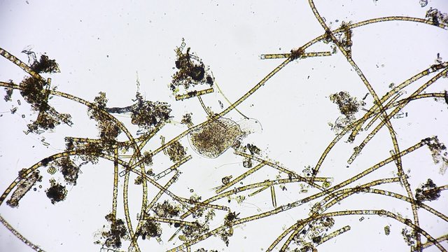 Mikroorganismus unter dem Mikroskop - Mikrokosmos - 1080p Full HD