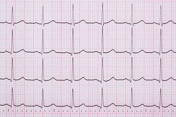 Close up of a Electrocardiograph also known as a EKG