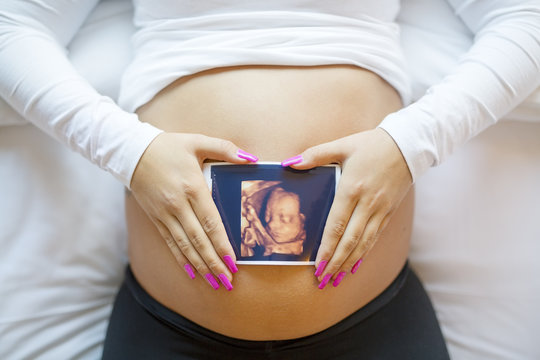 Pregnant woman holds ultrasound photo on the belly in bed