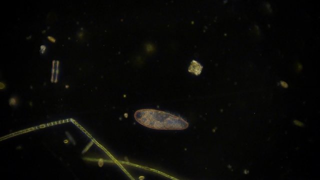 Mikroorganismus unter dem Dunkelfeldmikroskop - Mikrokosmos - 1080p Full HD 