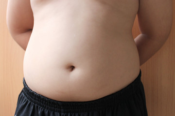 Fototapeta na wymiar White skin stomach of fat boy, overweight belly child standing wear black pants.