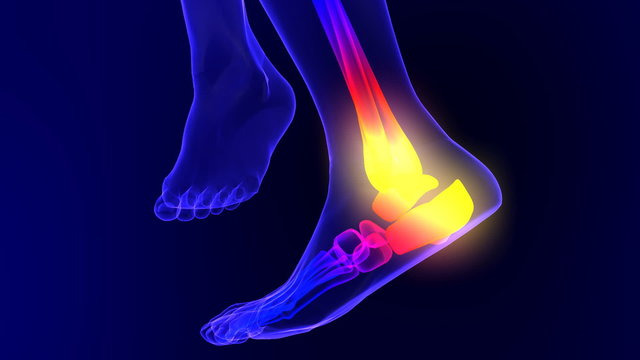 X-ray skeleton animation of ankle pain