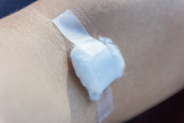 cotton alcohol closed on arm after blood donation