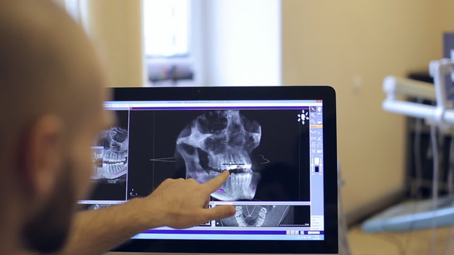 patient and doctor discuss the 3D visualization model 