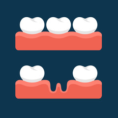 Teeth with Gum for Healthcare. Vector