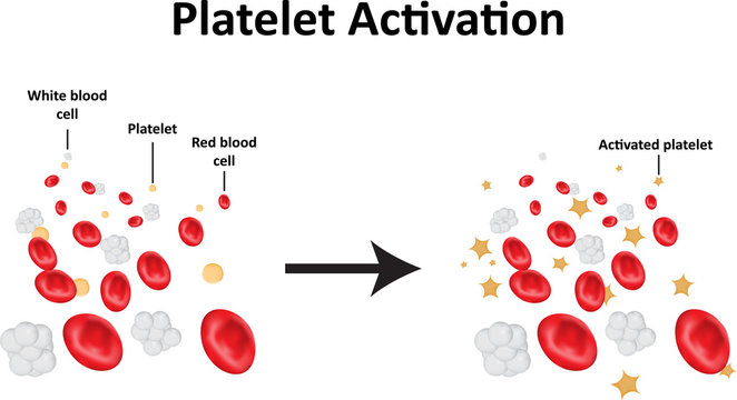 Platelet Activation