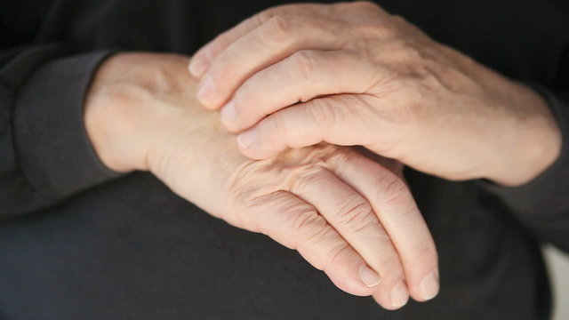 Senior man scratches the eczema rash on his hand.
