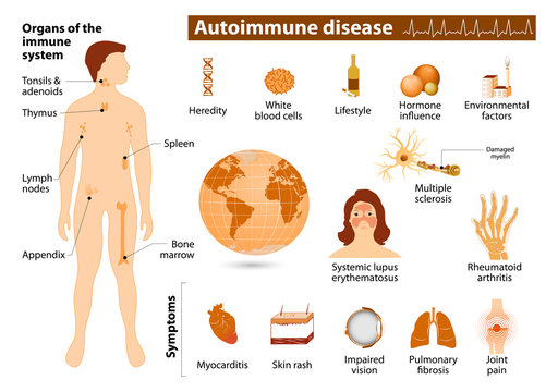Autoimmune disease infographic