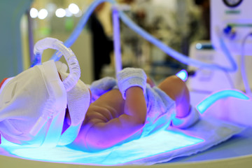 Newborn baby in incubator and medical devices - obrazy, fototapety, plakaty