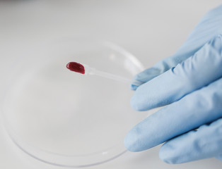 close up of scientist with blood sample in lab