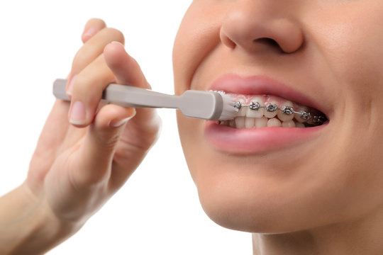 Woman with dental braces holding toothbrush
