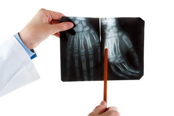 X-ray of human hand