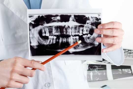 Panoramic dental X-Ray in hand.