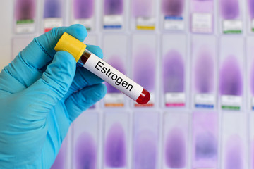 Blood for estrogen (Female hormone) testing