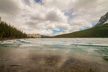 Laske Louise, Alberta, Canada
