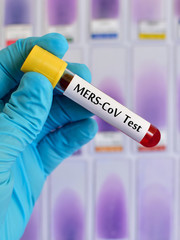 Blood sample for MERS-CoV (Middle East respiratory syndrome coronavirus) testing