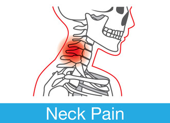 Outline of neck and bone which have pain from miss on body position in lifestyle. This is medical illustration