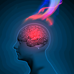 Fototapeta premium Vector Illustration of Headache with Flames
