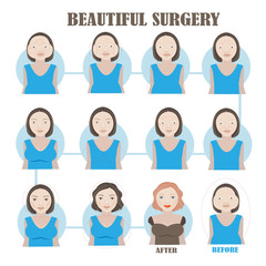 Vector women before and after cosmetic surgery. Cartoon character illustration series