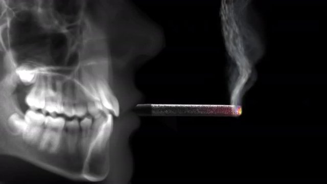 human radiography smoking