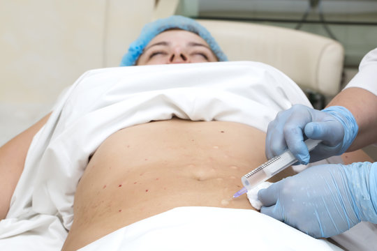 woman is in the process cellulite mesotherapy clinic
